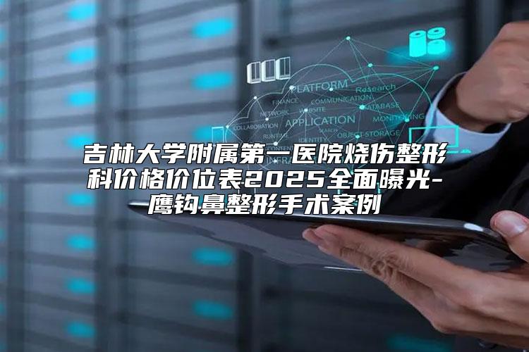 吉林大学附属第一医院烧伤整形科价格价位表2025全面曝光-鹰钩鼻整形手术案例