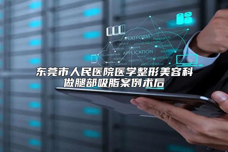 东莞市人民医院医学整形美容科做腿部吸脂案例术后