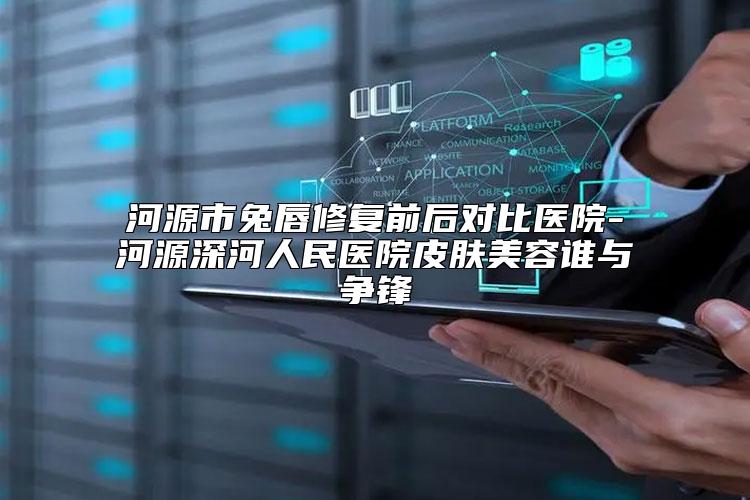 河源市兔唇修复前后对比医院-河源深河人民医院皮肤美容谁与争锋