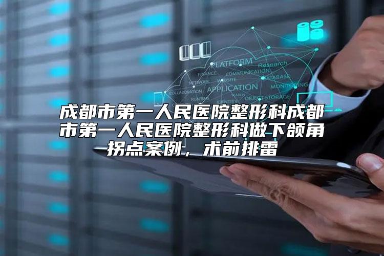 成都市第一人民医院整形科成都市第一人民医院整形科做下颌角拐点案例，术前排雷