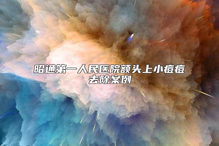 昭通第一人民医院额头上小痘痘去除案例